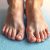 Nadmierne pocenie się stóp – przyczyny, objawy i skuteczne leczenie
